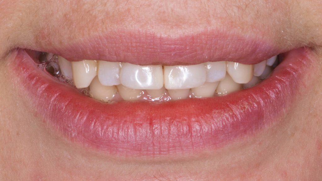 Портфолио - после 2