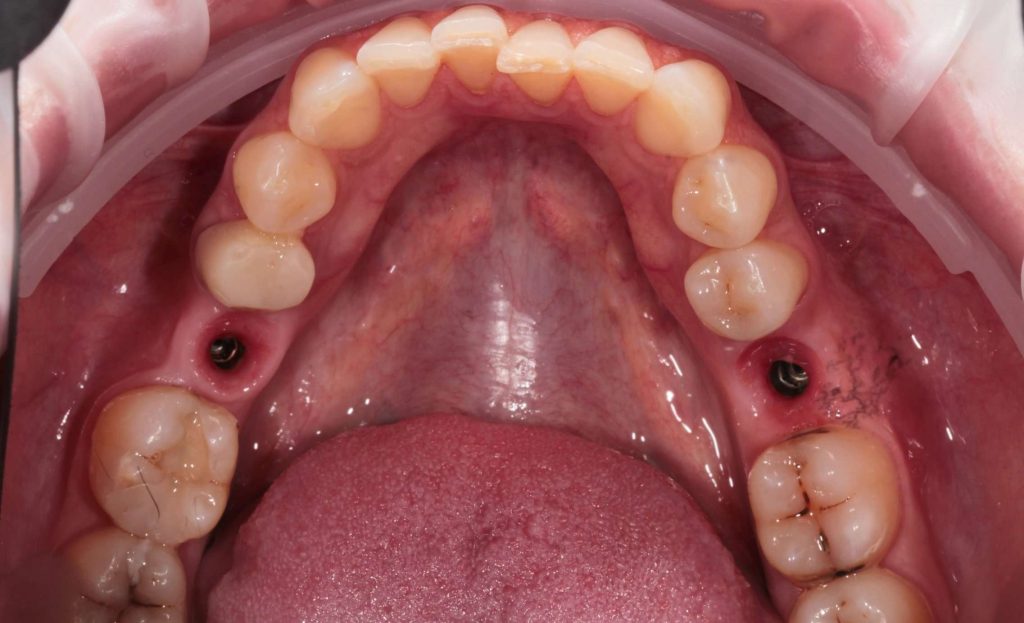 Портфолио - основное изображение
