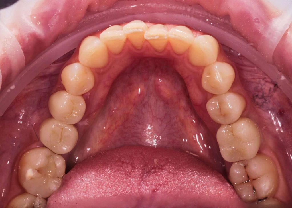 Портфолио - после 1