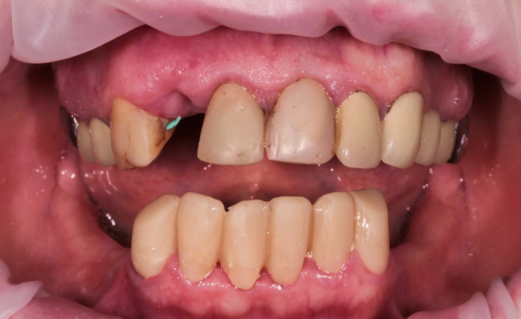 Портфолио - основное изображение