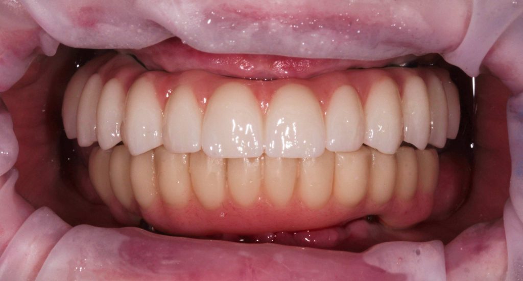 Портфолио - после 2