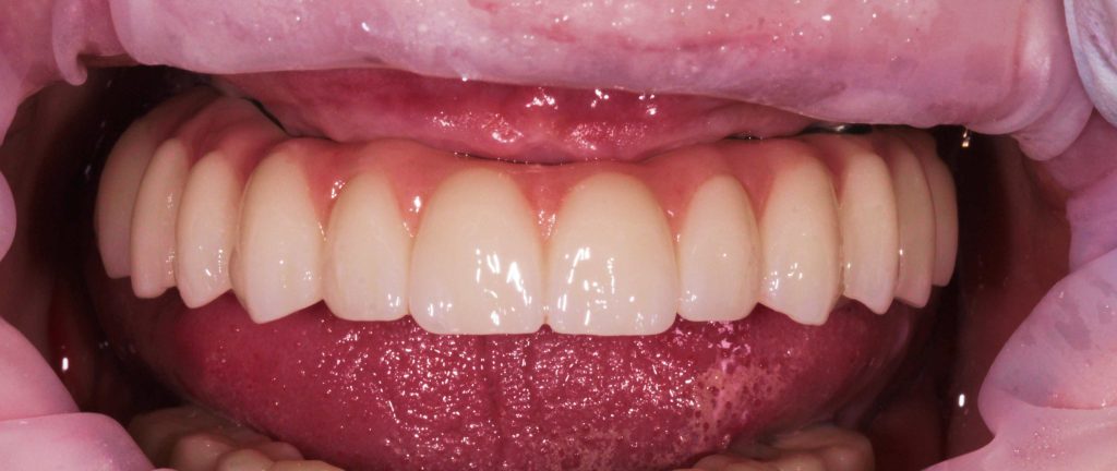 Портфолио - после 1