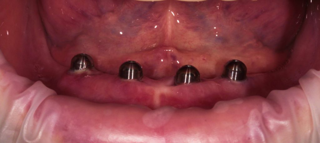 Портфолио - до 2