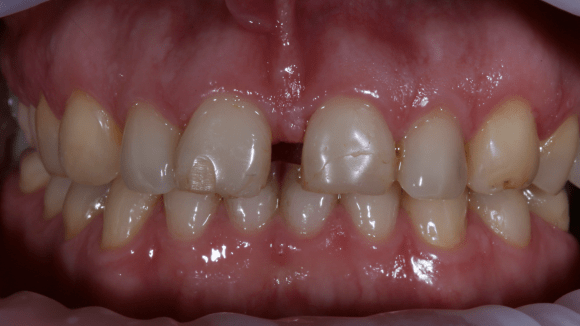 Портфолио - до 4