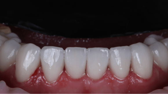 Портфолио - после 3