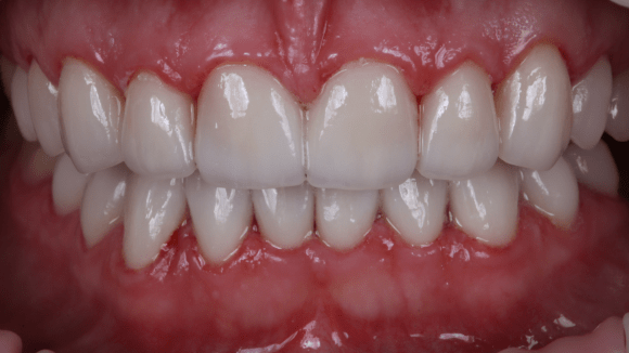 Портфолио - после 4