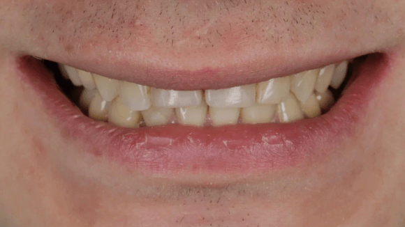 Портфолио - до 3