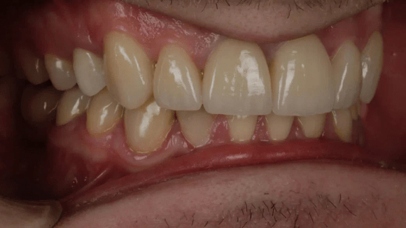 Портфолио - после 4