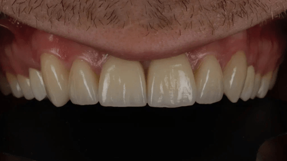 Портфолио - после 2