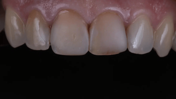 Портфолио - основное изображение