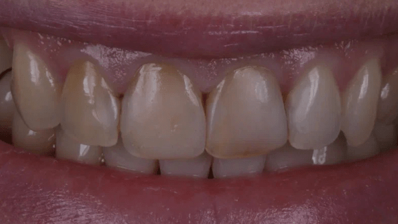 Портфолио - до 3