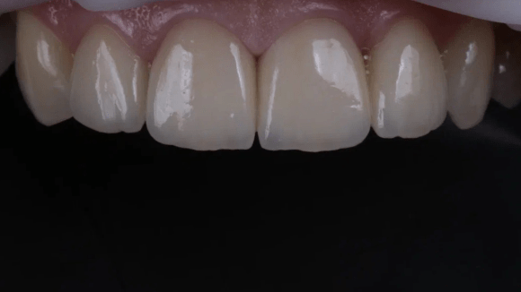 Портфолио - после 1