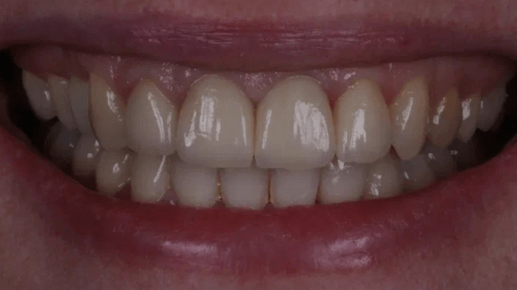 Портфолио - после 2