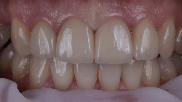 Портфолио - после 3