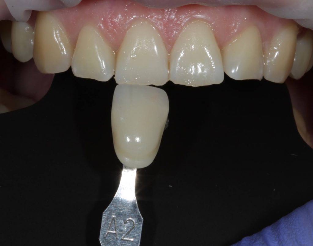 Портфолио - основное изображение