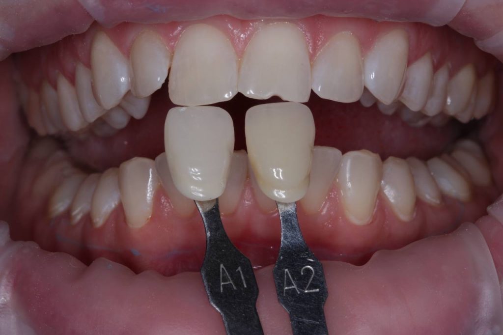 Портфолио - после 1