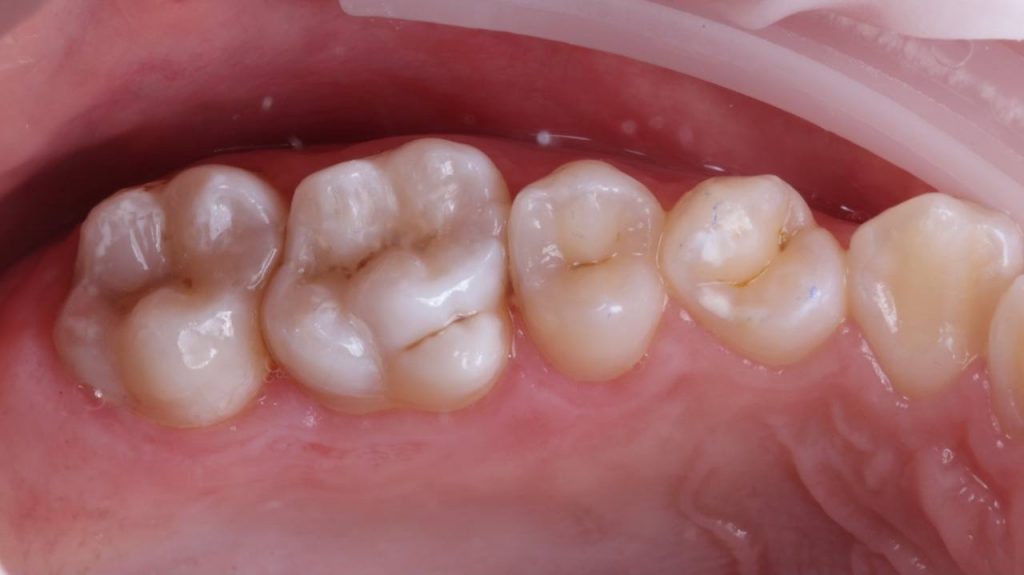 Портфолио - после 1