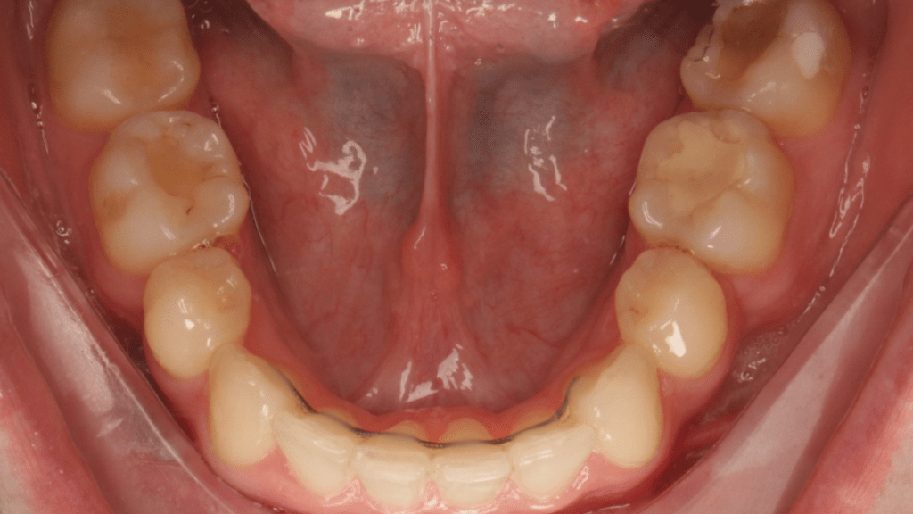 Портфолио - после 1