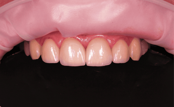 Портфолио - после 2