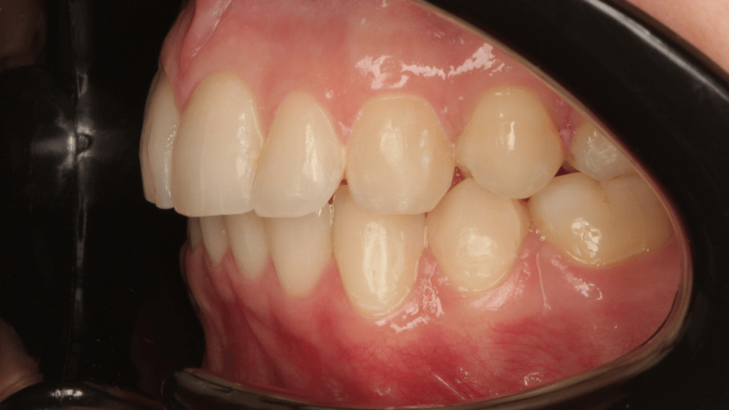 Портфолио - после 4