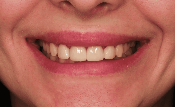 Портфолио - после 4