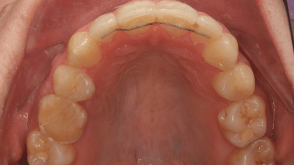 Портфолио - после 5