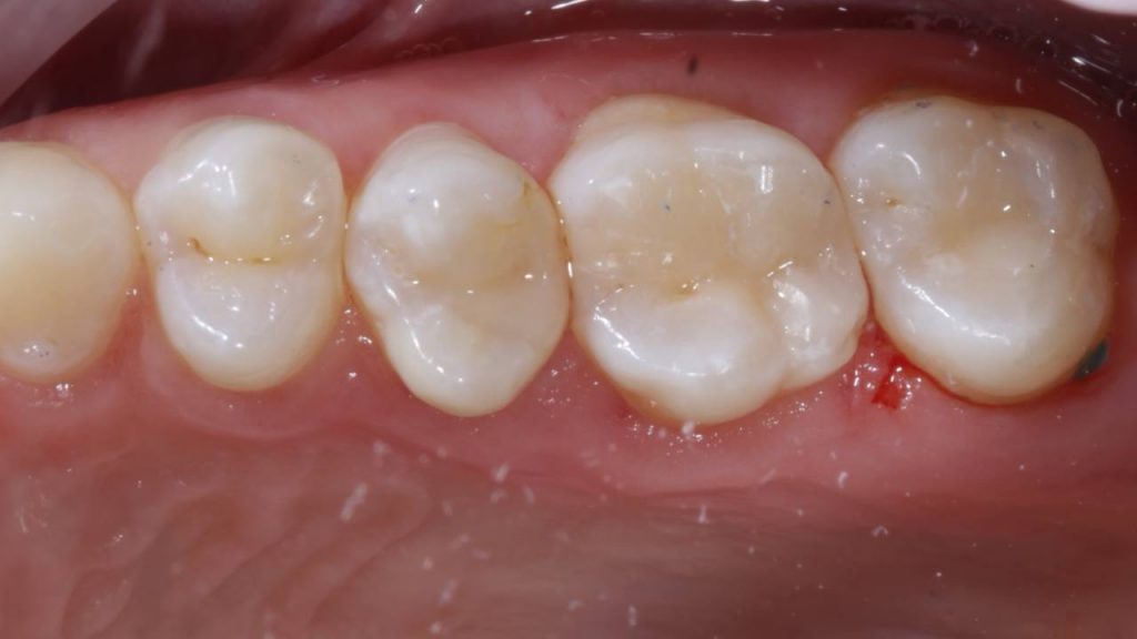 Портфолио - после 1