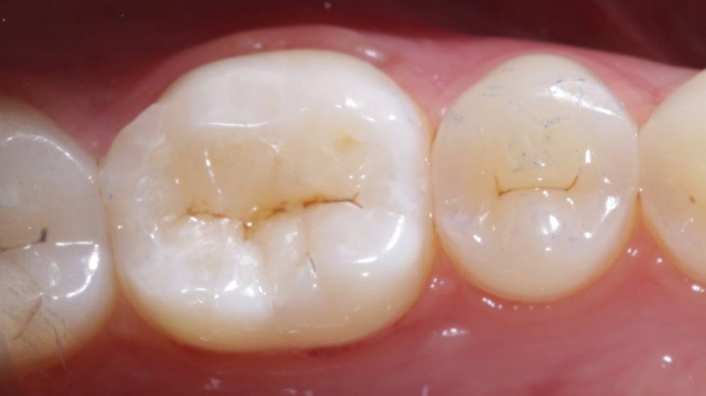 Портфолио - после 1