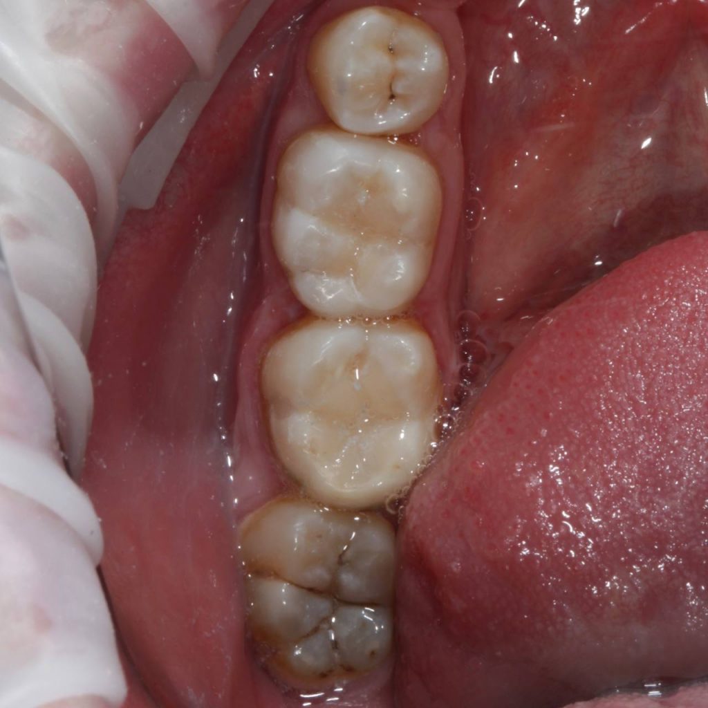 Портфолио - после 1