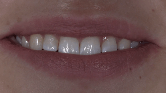 Портфолио - до 2