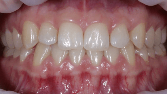 Портфолио - основное изображение