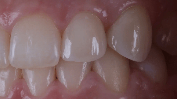 Портфолио - после 4