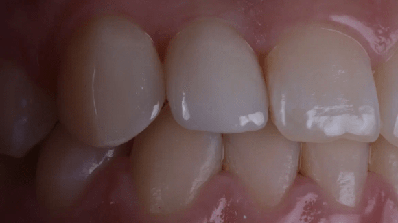 Портфолио - после 3