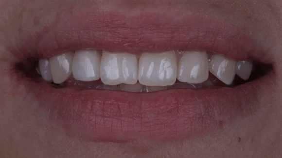 Портфолио - после 2