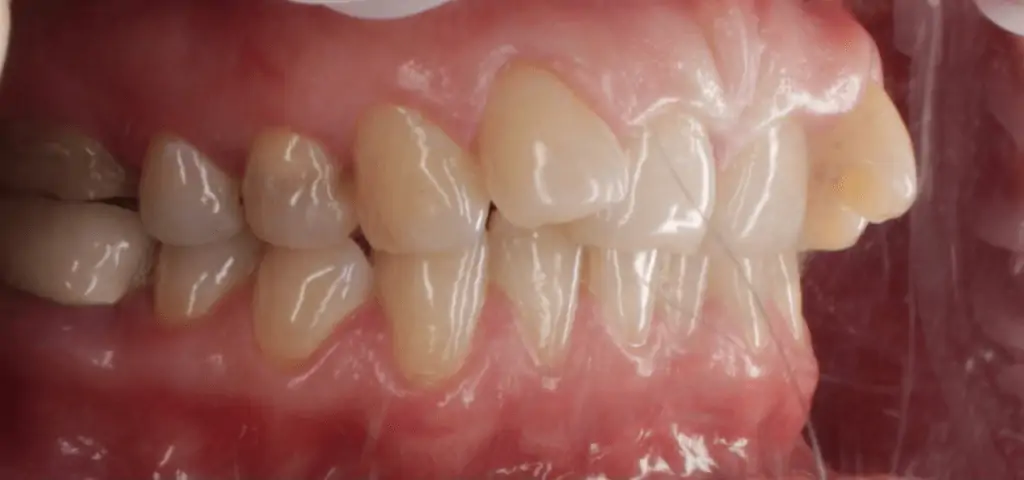 Портфолио - после 2