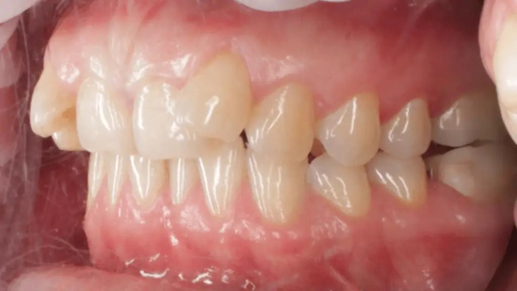 Портфолио - после 3