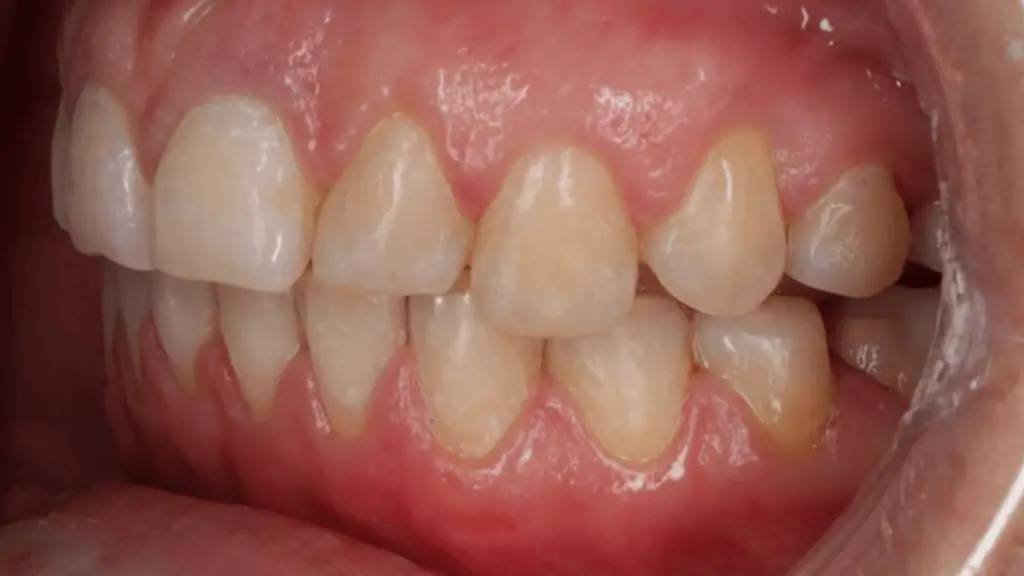 Портфолио - до 3