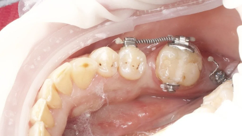 Портфолио - основное изображение