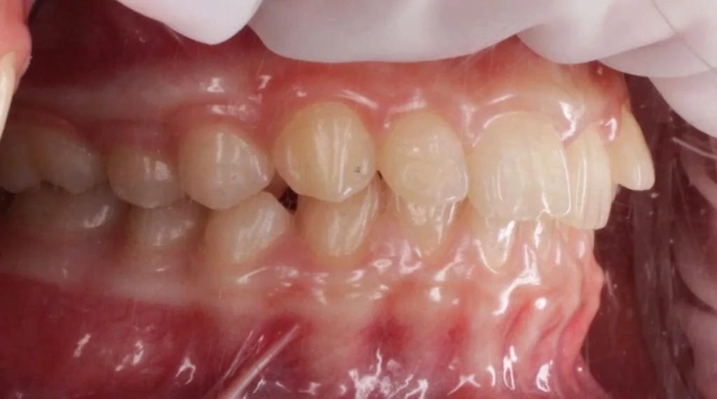 Портфолио - до 2