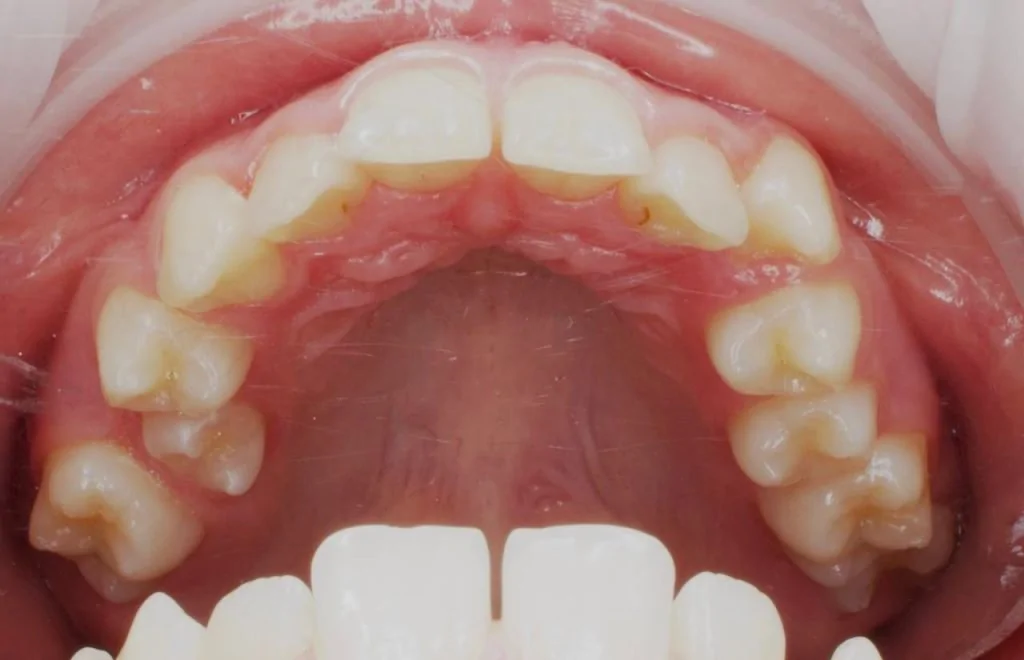 Портфолио - после 4