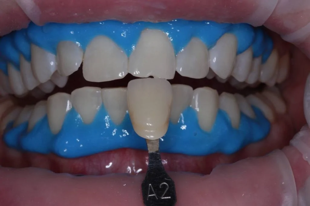 Портфолио - до 2