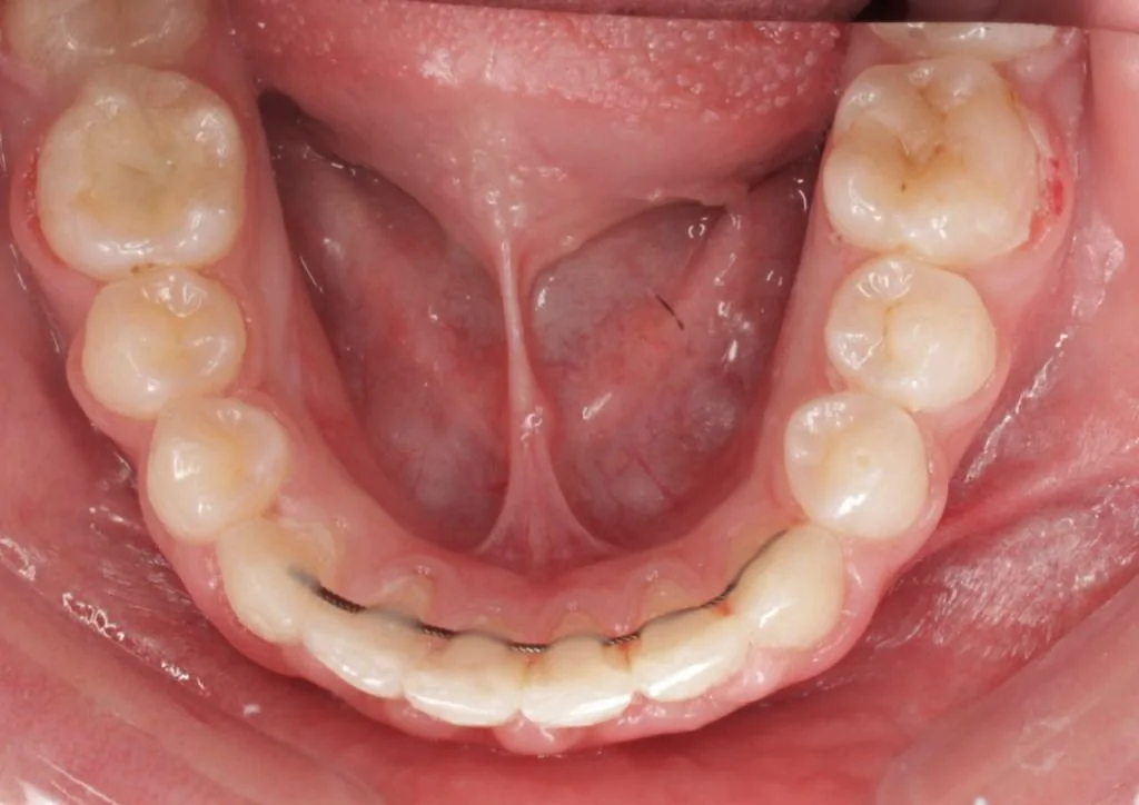 Портфолио - до 3