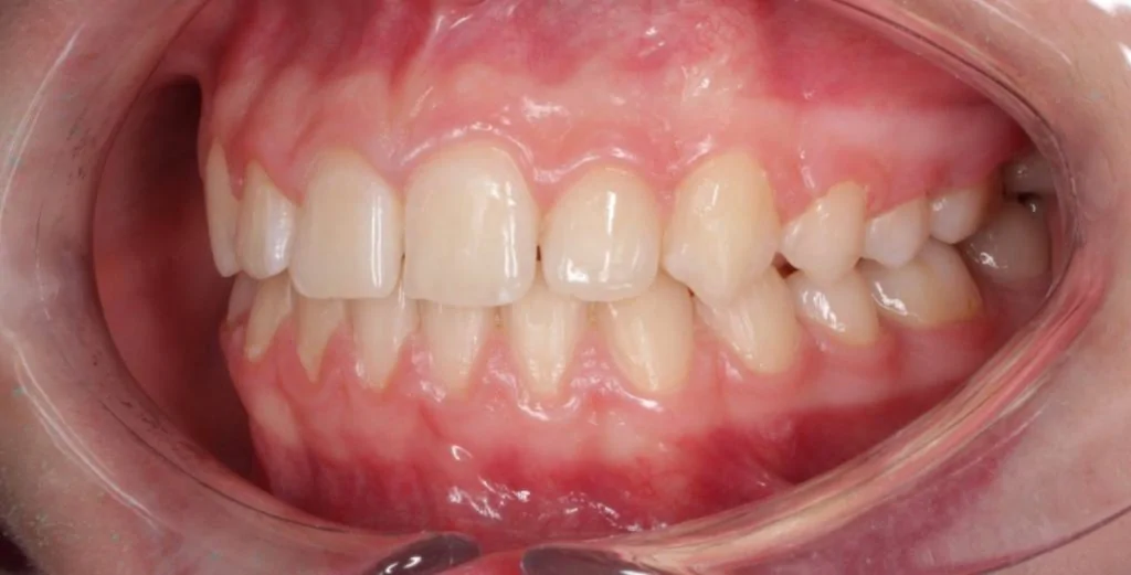 Портфолио - до 2