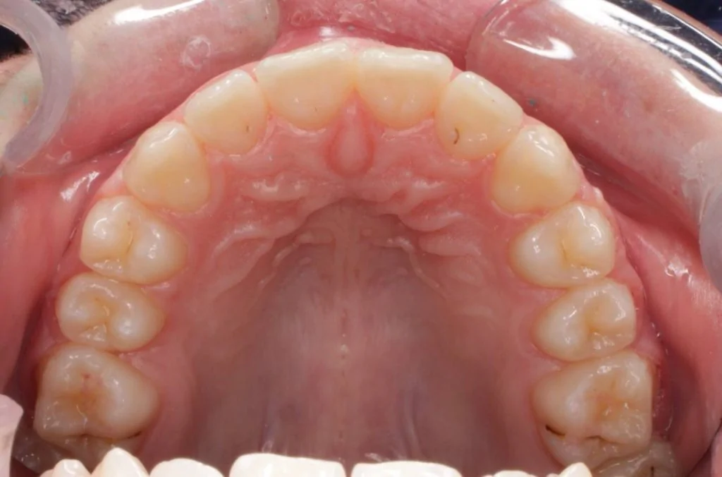 Портфолио - до 4