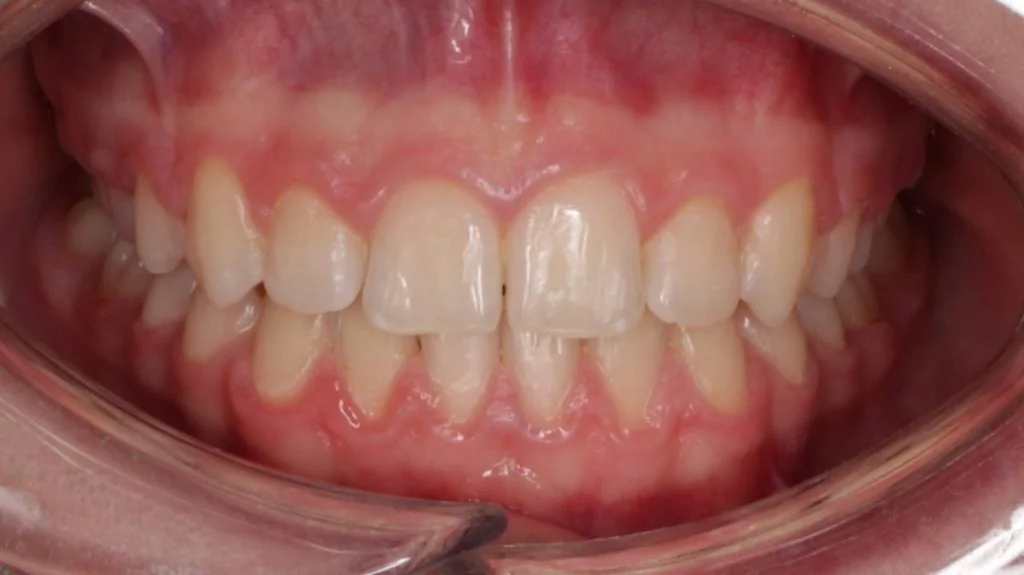 Портфолио - основное изображение