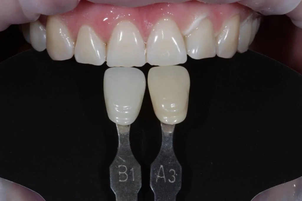 Портфолио - основное изображение