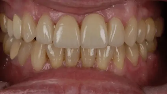 Портфолио - основное изображение