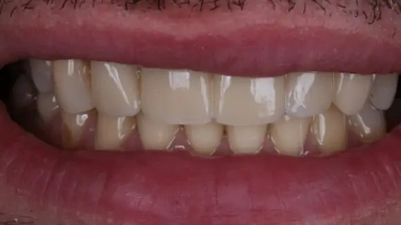 Портфолио - основное изображение