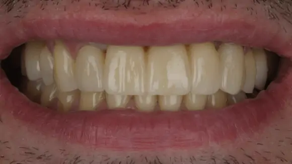 Портфолио - после 1