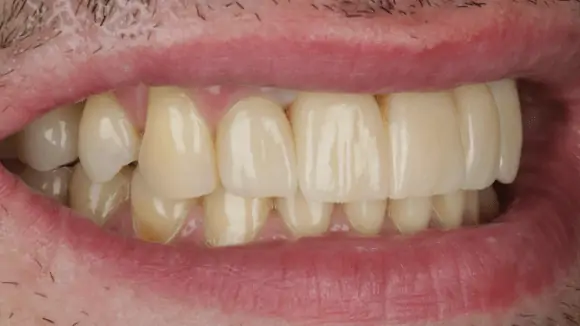 Портфолио - после 2